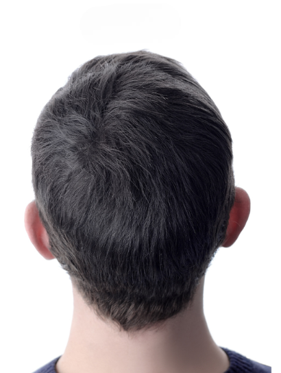 image comparison after